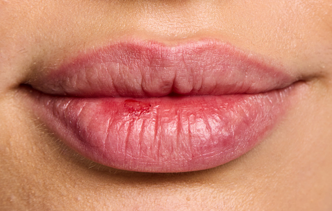 Close up of a model's lips before applying the Lanolips Hyaluronic Lip Oil in Honey. 
